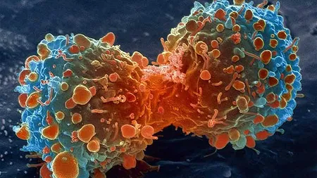 Descoperire românească împotriva cancerului. Ce plantă stopează multiplicarea celulelor canceroase