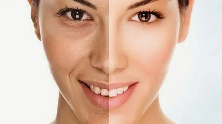 Remedii anti-rid ieftine şi naturale