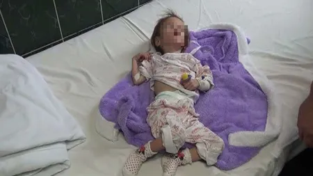 SCHIMBARE MIRACULOASĂ. Fetiţa care la 4 ani cântărea doar 5 kg a devenit aproape obeză VIDEO