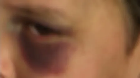 Un copil de 4 ani, BĂTUT CRUNT de unchiul său VIDEO