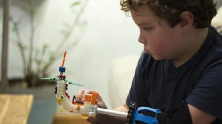 Povestea EMOŢIONANTĂ a băieţelului care şi-a construit singur o proteză din PIESE DE LEGO