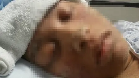 DOCTORII au RĂMAS MASCĂ: SINGURA femeie din lume căreia în creşte ASTA în loc de păr pe tot corpul VIDEO