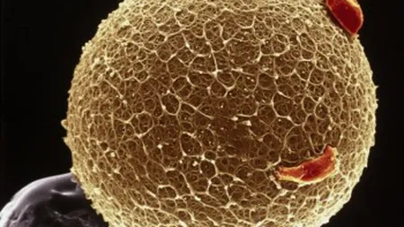Dereglările de ovulaţie - un inamic frecvent al fertilităţii