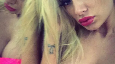 Simona Trașcă, după a patra operaţie la nas. Vezi cum arată FOTO
