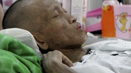 DISCRIMINARE: Un sat din Thailanda a alungat 48 de bolnavi de SIDA