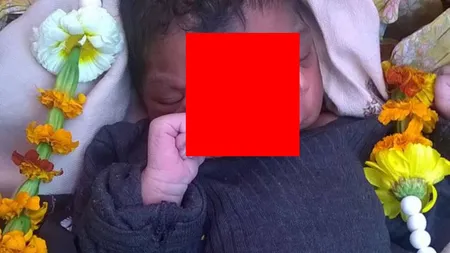 Povestea fetiţei născute cu trompă de elefant considerată un adevărat zeu FOTO