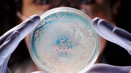 ALERTĂ în SUA: O bacterie LETALĂ a fost eliberată dintr-un laborator de înaltă securitate