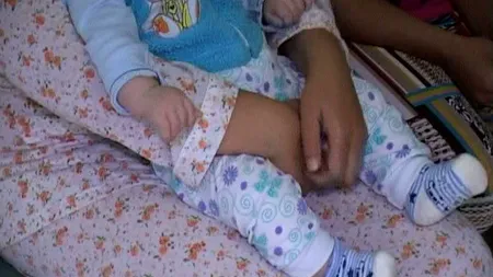 Bebeluş intoxicat cu o substanţă necunoscută, în stare gravă la spitalul din Botoşani