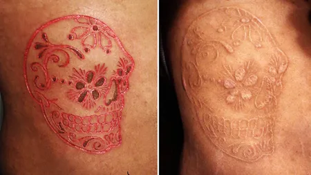 Ultima modă a împătimiţilor de tatuaje face furori în lume. Cum arată 