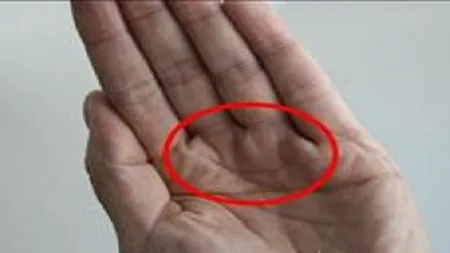 Nu toată lumea are această linie în palmă. Tu o ai? Ce semnificaţii are