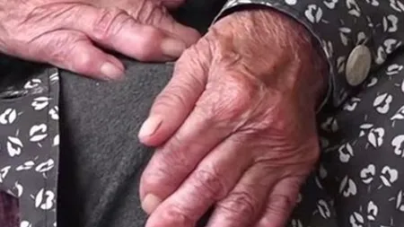 Însărcinată la 90 de ani! Cum arată femeia care ţine în pântec un copil pietrificat de mai bine de 50 de ani