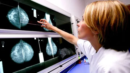 Eficacitatea mamografiilor a fost mult supraestimată până acum