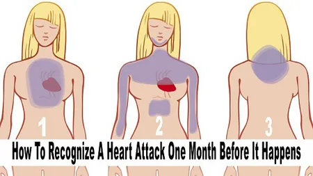 Cum să recunoşti un infarct cu o lună înainte de a se întâmpla