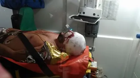 Scandal monstru între interlopi: O tânără a fost tunsă cu sabia şi desfigurată VIDEO