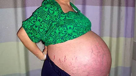 Cum arată femeia care a născut OPT COPII odată după ce a slăbit 60 de kilograme. A pozat NUD