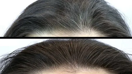 Un remediu natural te ajută să eviţi albirea părului