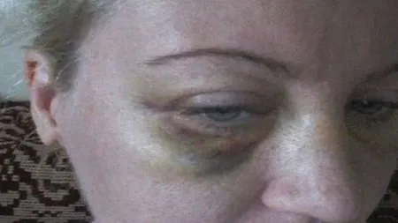 Bătută în faţa blocului, cere ajutor pe Facebook. Apelul disperat al unei femei din Timişoara