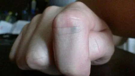 De 13 ani avea un semn ciudat, gri, pe un deget de la mâna dreaptă. Nu i-a venit să creadă ce era!