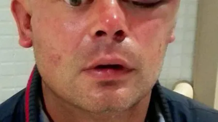 Imagini desprinse din filmele de groază au fost surprinse în Ibiza. Un tânăr a fost atacat de un canibal VIDEO