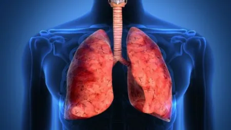 Un nou tratament pentru cancerul pulmonar, aprobat de Comisia Europeană