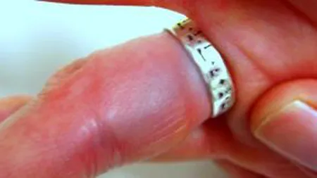Asta trebuie să faci ca să-ţi scoţi inelul de pe degetul umflat! Cât e de simplu  VIDEO