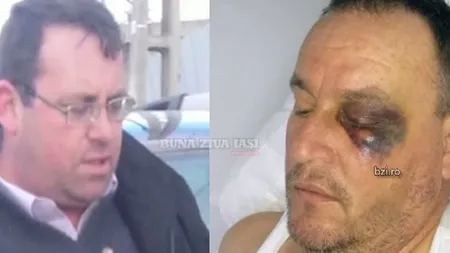 Un bărbat din judeţul Iaşi îl acuză pe primar că l-a bătut şi l-a lovit cu maşina