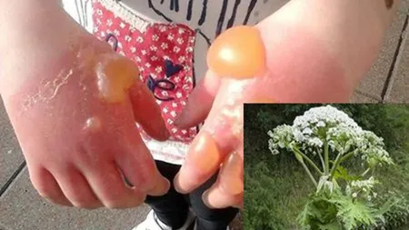 Alertă maximă în toată ţara! Nu atingeţi această plantă. Este extrem de periculoasă
