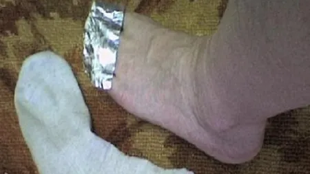 De ce e bine să-ţi pui folie de aluminiu pe degetele picioarelor