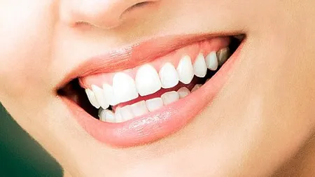 Vrei să stai departe de cabinetul stomatologic? Alimente pentru sănătatea dinţilor