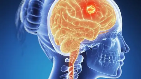 A aflat că este însărcinată după ce a descoperit ca are cancer la creier. Decizia RADICALĂ a femeii FOTO
