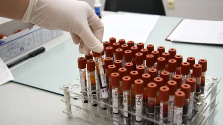 Test sangvin pentru detectarea precoce a cancerului, rezultate promiţătoare