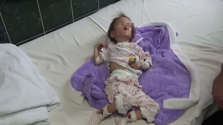 Fetiţa din Vaslui care a fost hrănită numai cu pufuleţi şi ceai, adoptată de medici. Ce decizie a luat tatăl lui Flori
