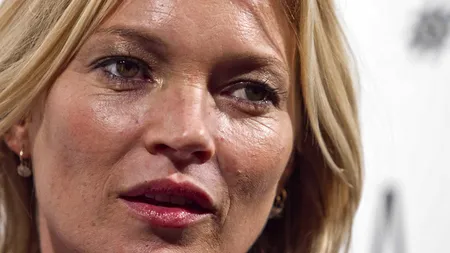 Kate Moss s-a accidentat la schi în Alpii elveţieni