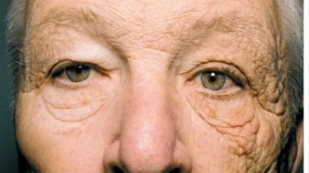 Imaginea aceasta te va face să te gândeşti de două ori înainte să mai vrei să te bronzezi FOTO
