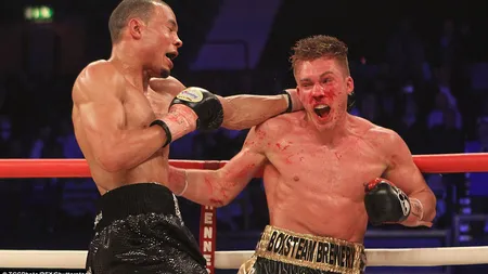 Boxerul Nick Blackwell se află în comă după un meci disputat la Londra VIDEO ŞOCANT