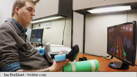 PREMIERĂ MEDICALĂ: Un bărbat paralizat şi-a recuperat mobilitatea mâinii datorită unui microcip VIDEO