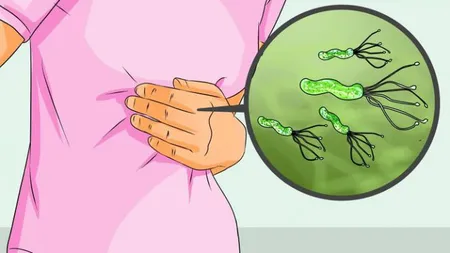 Cum se transmite bacteria care produce cancerul de stomac. Jumătate din oameni o au
