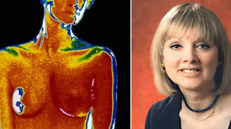 Dieta chinezească: Cazul femeii care s-a vindecat singură de cancer la sân în doar şase săptămâni