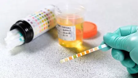 Kaiacistul Ionuţ Mitrea, depistat dopat cu meldonium. Ministrul Sportului: 
