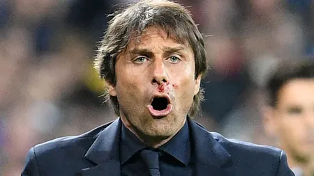 EURO 2016. Antrenorul Italiei, plin de sânge. Antonio Conte a fost lovit de propriul staff VIDEO