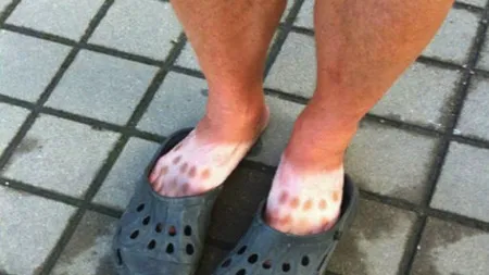 Porţi crocşi? Trebuie neapărat să citeşti asta