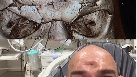 IMAGINI HORROR. Cea mai dură lovitură din ultimii 20 de ani în MMA. I-a rupt capul VIDEO