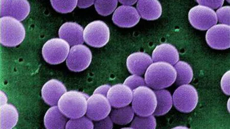 STUDIU:Sursa pentru un posibil nou antibiotic a fost descoperită în cavitatea nazală
