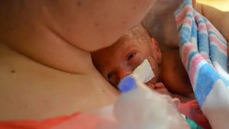 Video pentru inimă: A petrecut primele 3 luni din viaţă la terapie intensivă