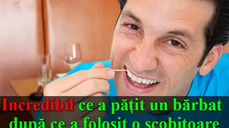 Incedibil ce a păţit un bărbat după ce a folosit o scobitoare! Doctorii au fost şocaţi de ceea ce au descoperit