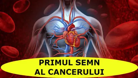 Semnele care te ajută să depistezi cancerul din timp