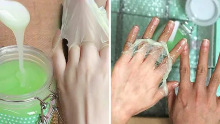Avea pete închise la culoare pe mâini! Toată lumea a întrebat-o cum a scăpat de ele după ce a apărut aşa