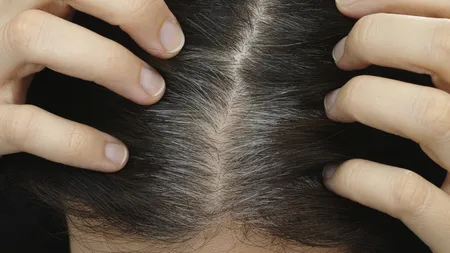 Remediul care îţi redă culoarea naturală a părului. Fără niciun un fir alb, fără tratamente scumpe
