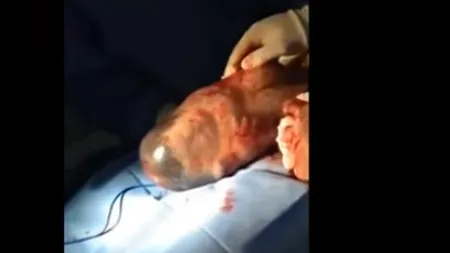 Video-ul care a făcut înconjurul lumii. Momentul în care un bebeluş iese din sacul amniotic