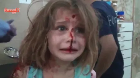 Înregistrare dramatică. Momentul în care o fetiţă din Siria, rănită în urma unui raid aerian, strigă după tatăl ei VIDEO